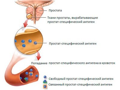 Схема лечения бактериального простатита